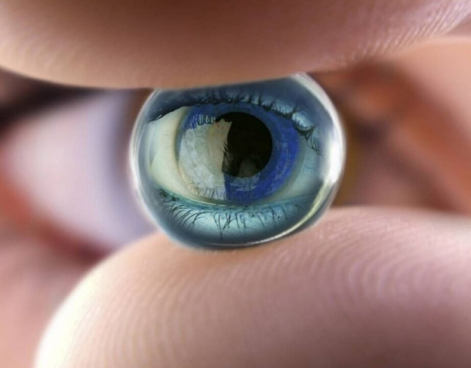 Les lentilles orthokératologiques nocturnes arrêtent la progression de la déficience visuelle